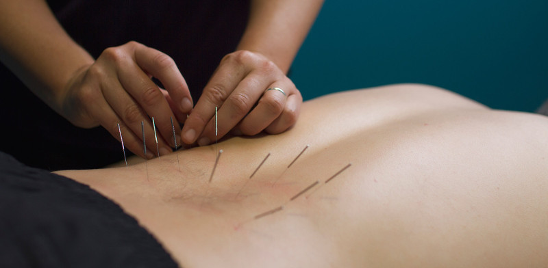 Dry-Needling-2000x980-smaller
